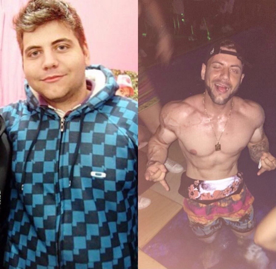 PK Gonzaga antes e depois
